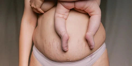 La sueur et le pH après la grossesse : quelles répercussions sur nos bijoux ?